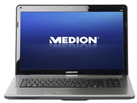 Medion Notebook Akoya P7615